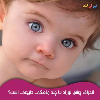 انحراف چشم نوزاد تا چند ماهگی طبیعی است؟