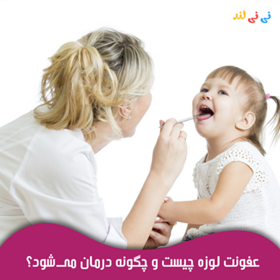 عفونت لوزه چیست و چگونه درمان می شود؟ راهنمای كامل برای مقابله با التهاب لوزه عفونت لوزه چیست و چگونه درمان می شود؟ راهنمای كامل برای مقابله با التهاب لوزه